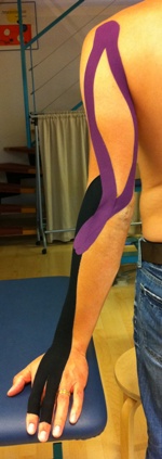 Kinematic Taping